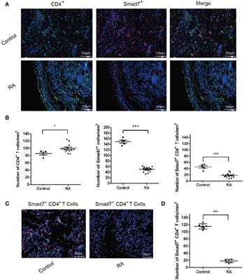 Hypermethylation of Smad7 in CD4+ T cells is associated with the disease activity of rheumatoid arthritis